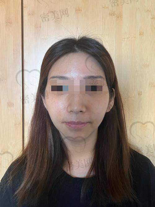 别再犹豫，赶紧开启你的美丽之旅