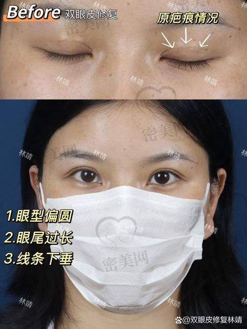 北京米兰柏羽丽都胡彬：专注眼鼻综合的技术实力派