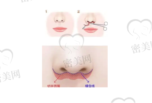 医院环境和服务怎么样?适不适合初次整形的用户?