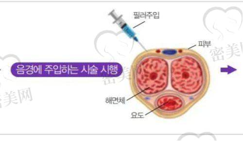 北京星医汇医疗美容门诊部特色项目: