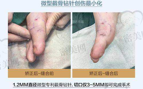 长沙天心艺脂医疗美容门诊部特色项目: