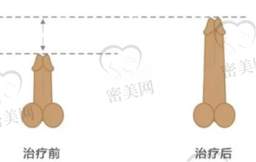 项目适配表格：懒人看这张一秒知道选谁