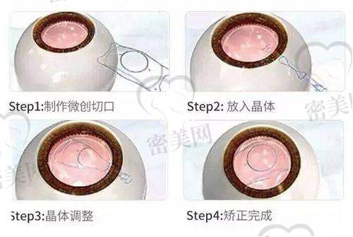 关于医疗保险政策及费用减免建议
