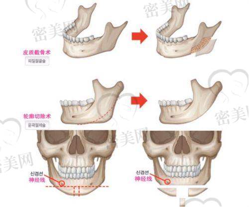 上海丽质医院是不是三等甲医院?