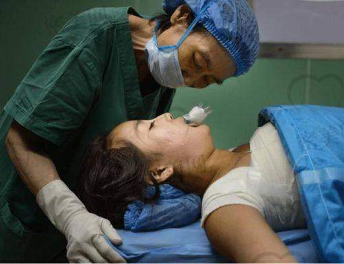真实体验者分享：修复后N年依然自然、稳定、不挛缩