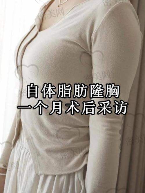 唐山煤医尚美整形医院郭万厚自体脂肪丰胸：技术优势大揭秘