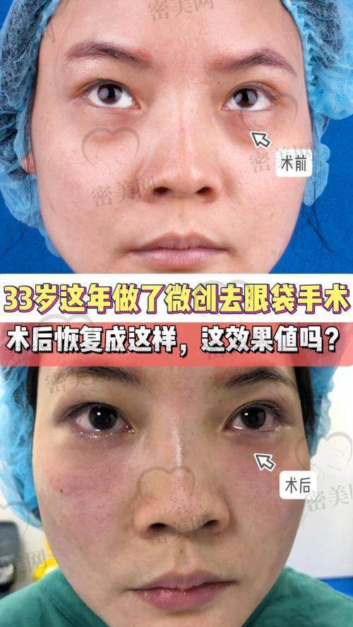 福州韩尔医疗美容门诊部——技术靠谱、修复快