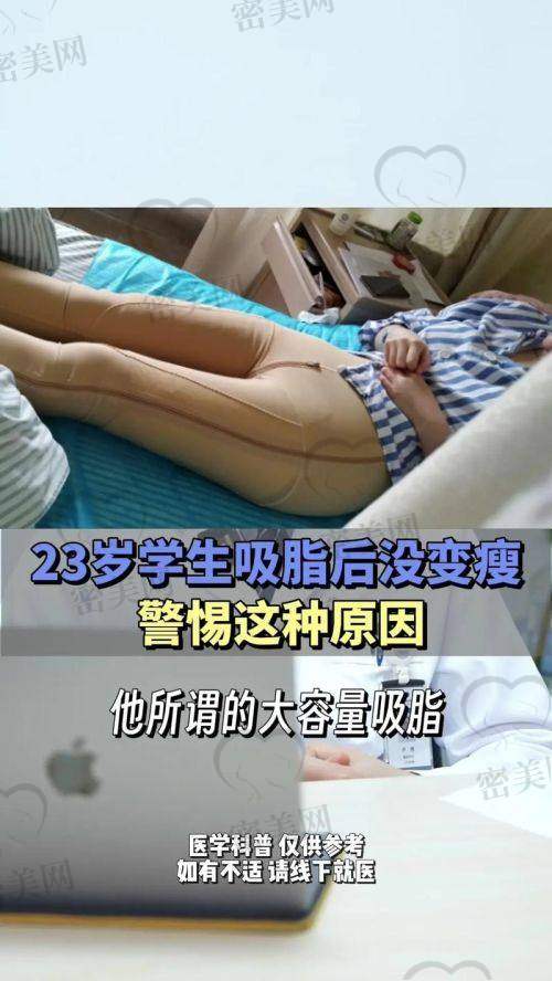 芜湖伊莱美整形——林娜医生当家