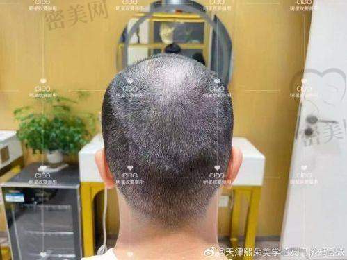 【杨杰医生擅长项目】