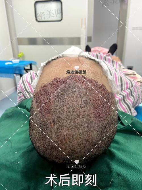 【杨杰医生怎么预约挂号？】