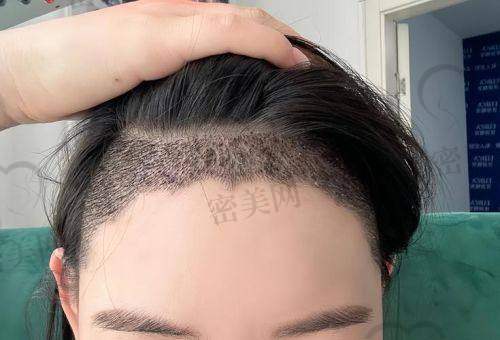 遂宁韩美医疗美容门诊部——赵刚医生