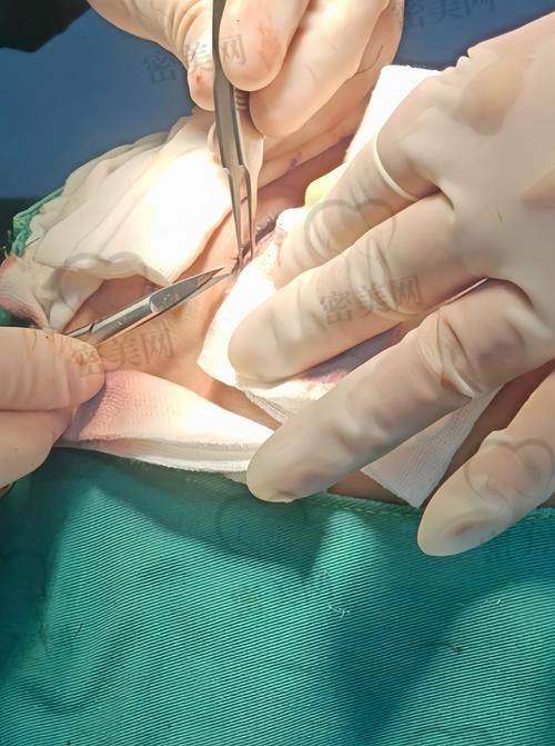 北京加减美医疗美容的真实实例分享