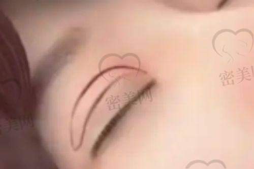 石家庄美漾医疗美容诊所:热门项目全新升级,精细塑美