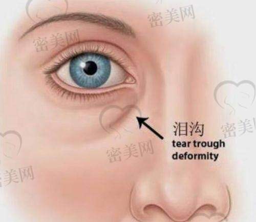 必看补贴:别被错过的隐藏省钱补贴给错过!