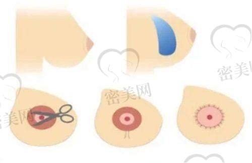 长春姬安娣招风耳/折耳等耳部整形真实实例展示