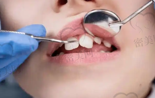 【太原恒伦口腔新民门诊部怎么预约挂号?】