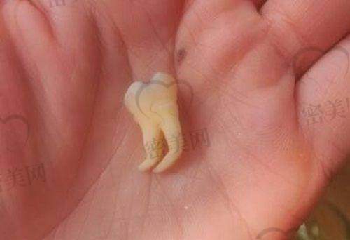 【 太原军大口腔科患者口碑评价：】