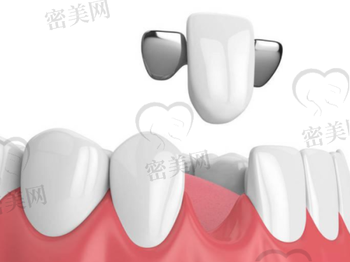 【山西离石张兰荣口腔诊所参考价格表:】