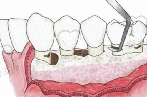 【太原泰康拜博口腔门诊部参考价格表:】
