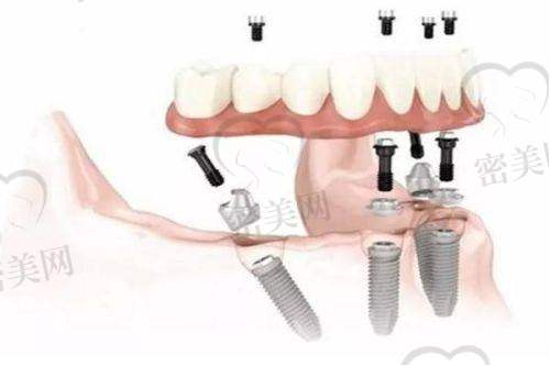 【太原泰康拜博口腔门诊部诊疗设备:】