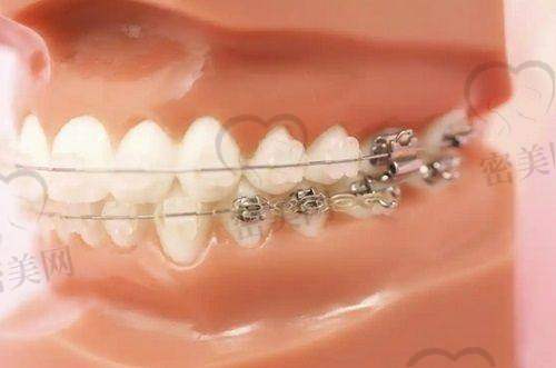 【  太原牙管家口腔门诊部医生名单:】