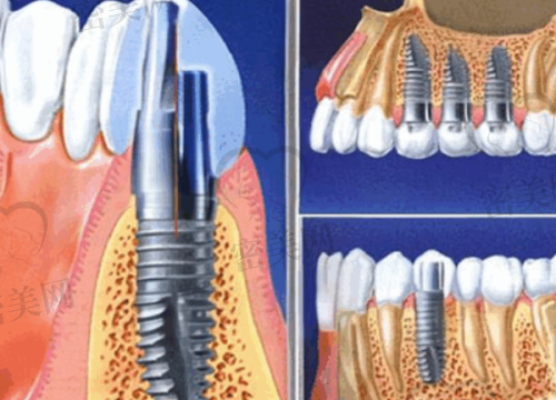 【晋中和顺嘉园口腔诊所设备与技术:】