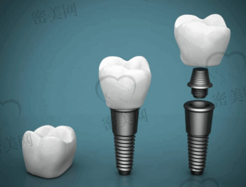 【临汾仁和中医和西医结合医院口腔科(麦特登口腔)特色项目:】