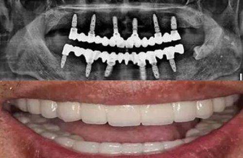 【晋中和顺嘉园口腔诊所患者口碑评价:】