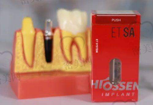 【太原康达口腔小店平阳南路门诊部特色项目:】