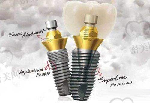 【太原优贝口腔门诊部怎么预约挂号?】