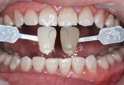 【山西晋中佳博口腔诊所医生团队:】