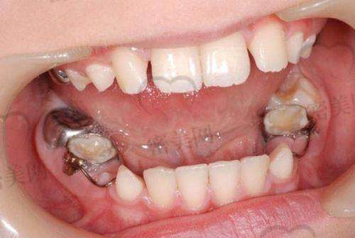 【太原恒伦并州路口腔门诊部患者口碑评价:】