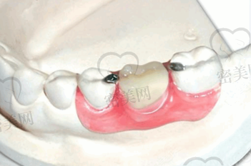 【太原康达口腔小店平阳南路门诊部是正规的吗?】