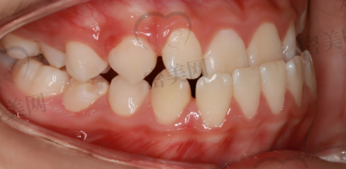 【临汾仁和中医和西医结合医院口腔科(麦特登口腔)参考价格表:】