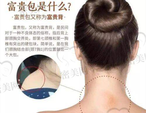 郝立君双眼皮手术流程+预约方式+价格详解