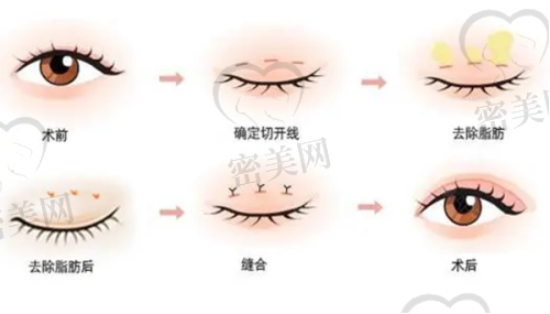 云南铜雀台美容医院:私密部位整形与胸部项目有竞争力