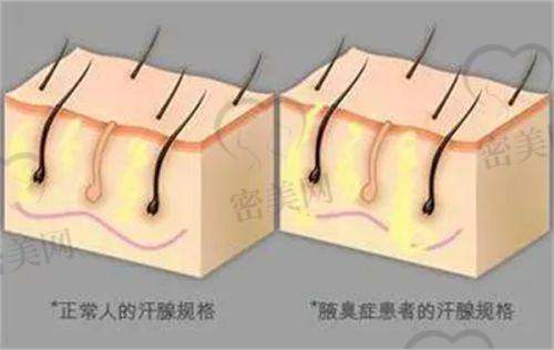上饶整形医院对比一览