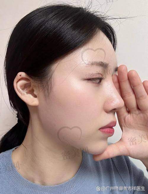 王旭明医生常见鼻整项目及价格区间