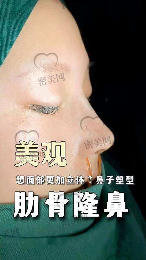 王旭明医生口碑评价：真实术后反馈超关键