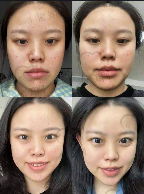 适合人群大不同:根据“岁数+诉求”来选