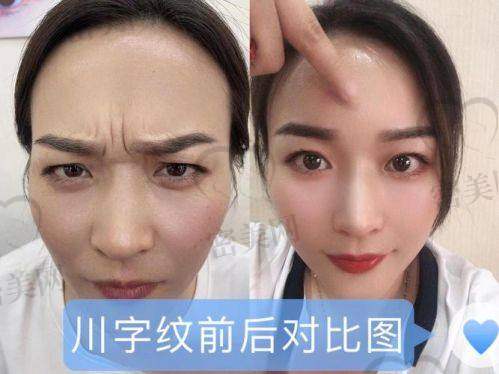 适合人群&项目选择建议