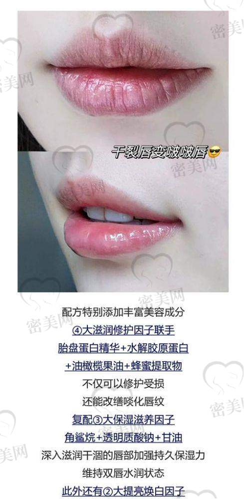 石家庄美联臣整形医院:唇部二次修复的理想之选