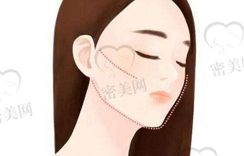 防城港华美医疗美容门诊部擅长哪些项目?都包括什么类别?