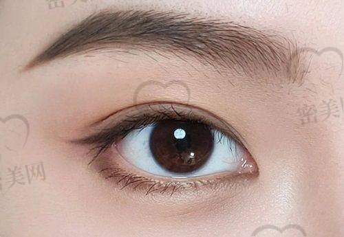 4. 广州晶美医疗美容(潘贰)