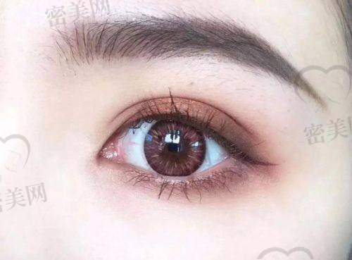 杜园园 & 张诗若 —— 高端医生亲坐诊，眼修复实力看得见