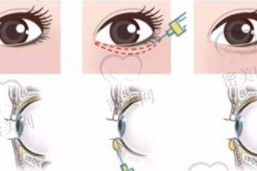 上海九院整形科接诊时间及提醒