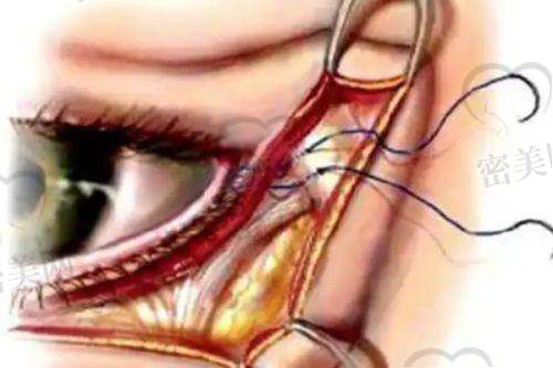 深圳瑞芙臣医疗美容门诊部怎么预约挂号?