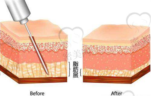如何预约曹孟君医生?注意哪些点不踩雷?