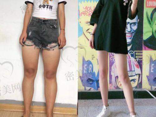 上海伊莱美医疗美容医院