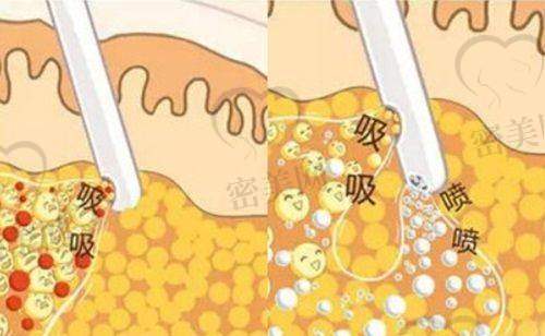 上海美莱医疗美容医院